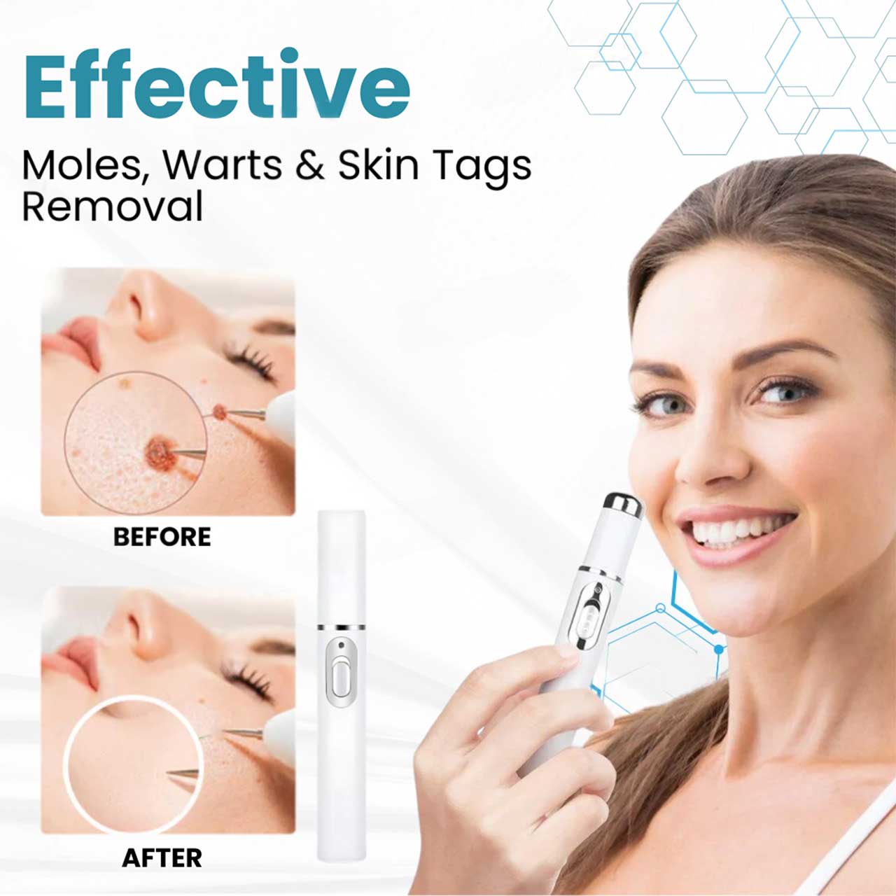 ClearBeam™ Pen - Dein Makelloser Teint Wartet: Erlebe die Haut, von der du immer geträumt hast!