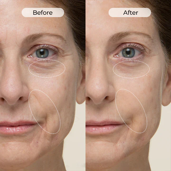 TightShift Serum – Holen Sie sich Ihr jugendliches Aussehen und Ihr Selbstvertrauen zurück.