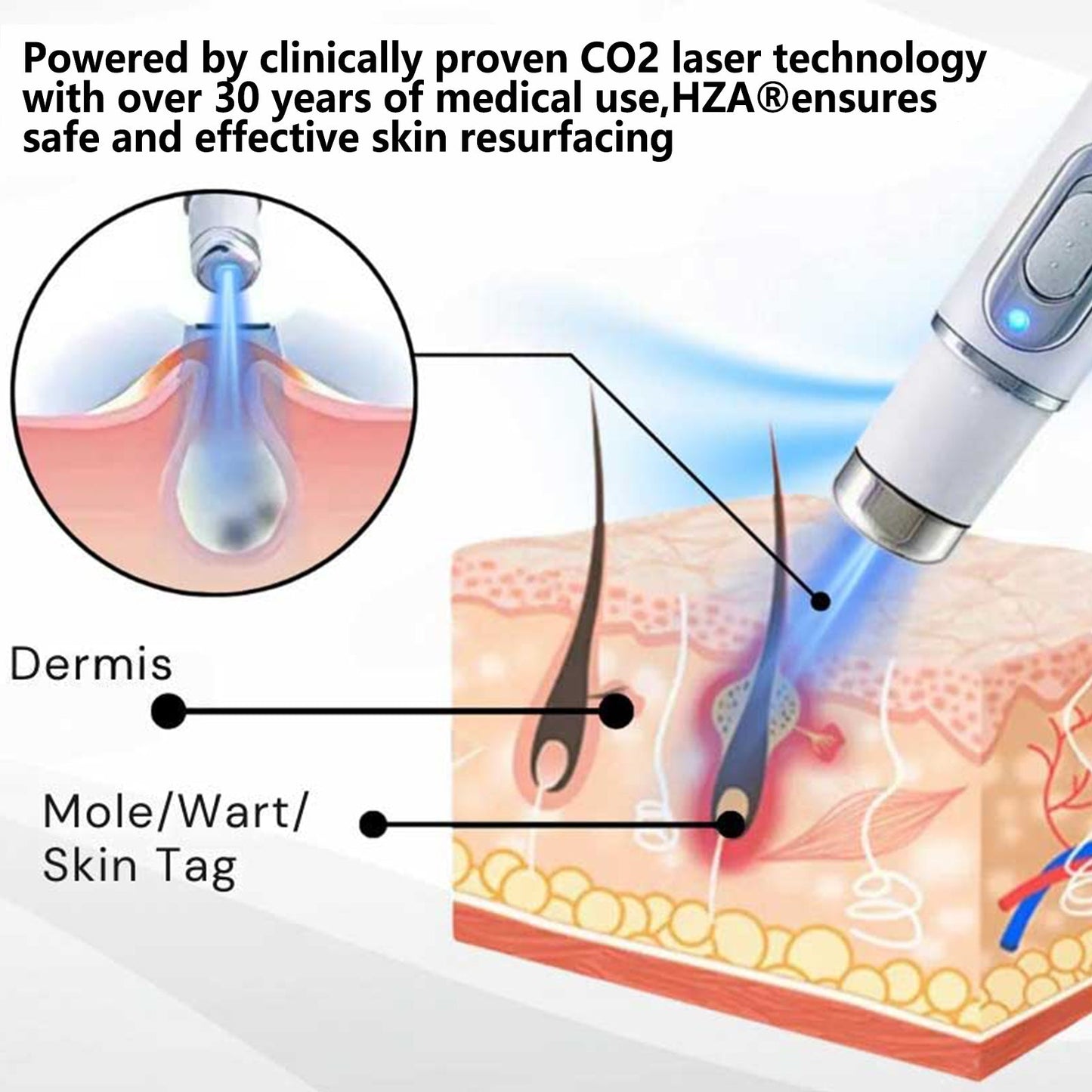ClearBeam™ Pen - Dein Makelloser Teint Wartet: Erlebe die Haut, von der du immer geträumt hast!