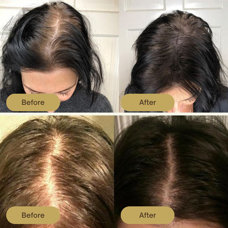 FloraBloom Hair Elixir - Vegane Weg zu wunderschönem Haar.