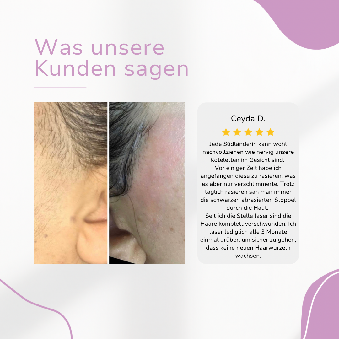 MILONDA Hair Remover - Deine schmerzfreie Revolution für seidig glatte Haut!