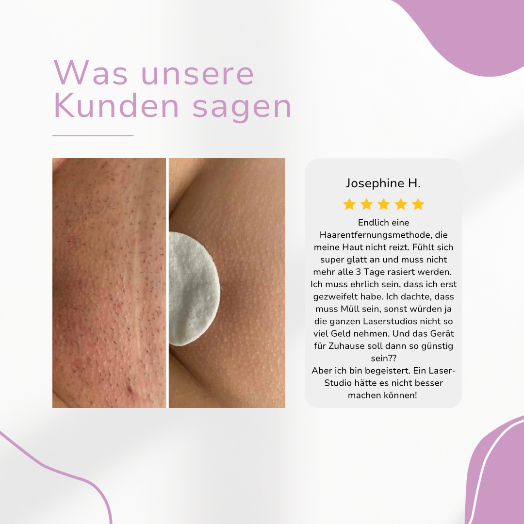 MILONDA Hair Remover - Deine schmerzfreie Revolution für seidig glatte Haut!