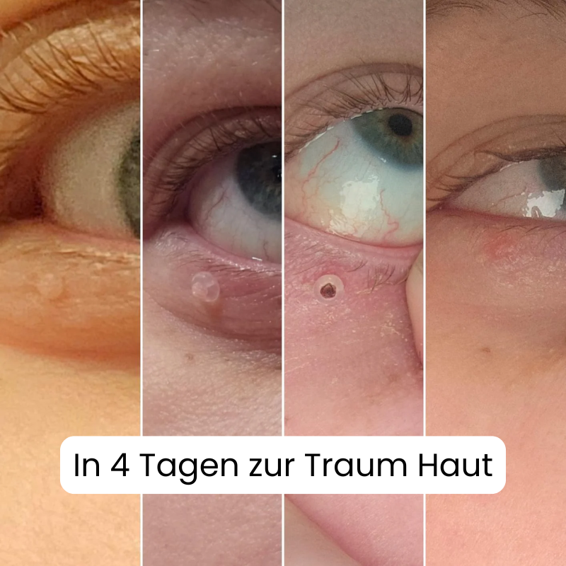Dermacare – Alcura | Verabschieden Sie sich von Unvollkommenheiten und begrüßen Sie Ihr Selbstvertrauen.