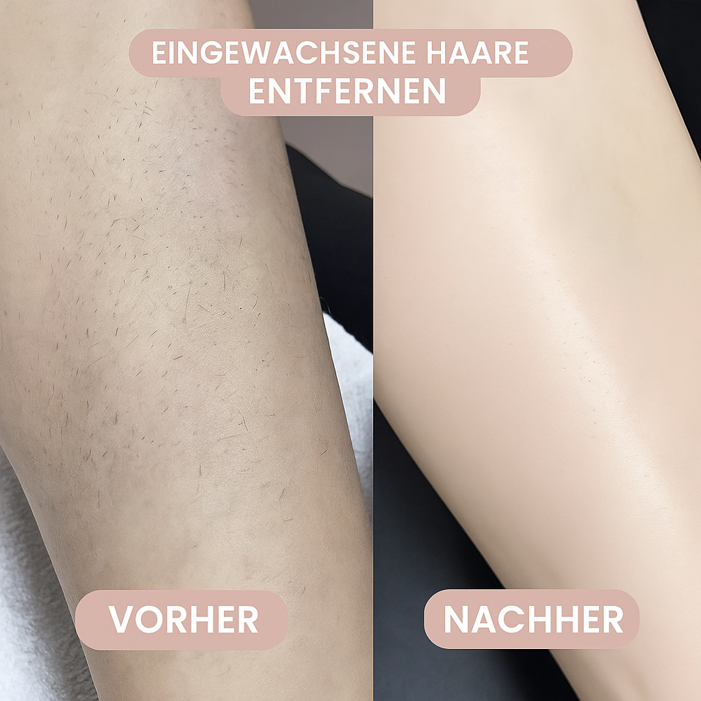 VelvetGlide - Erleben Sie mühelosen Komfort und Selbstvertrauen.