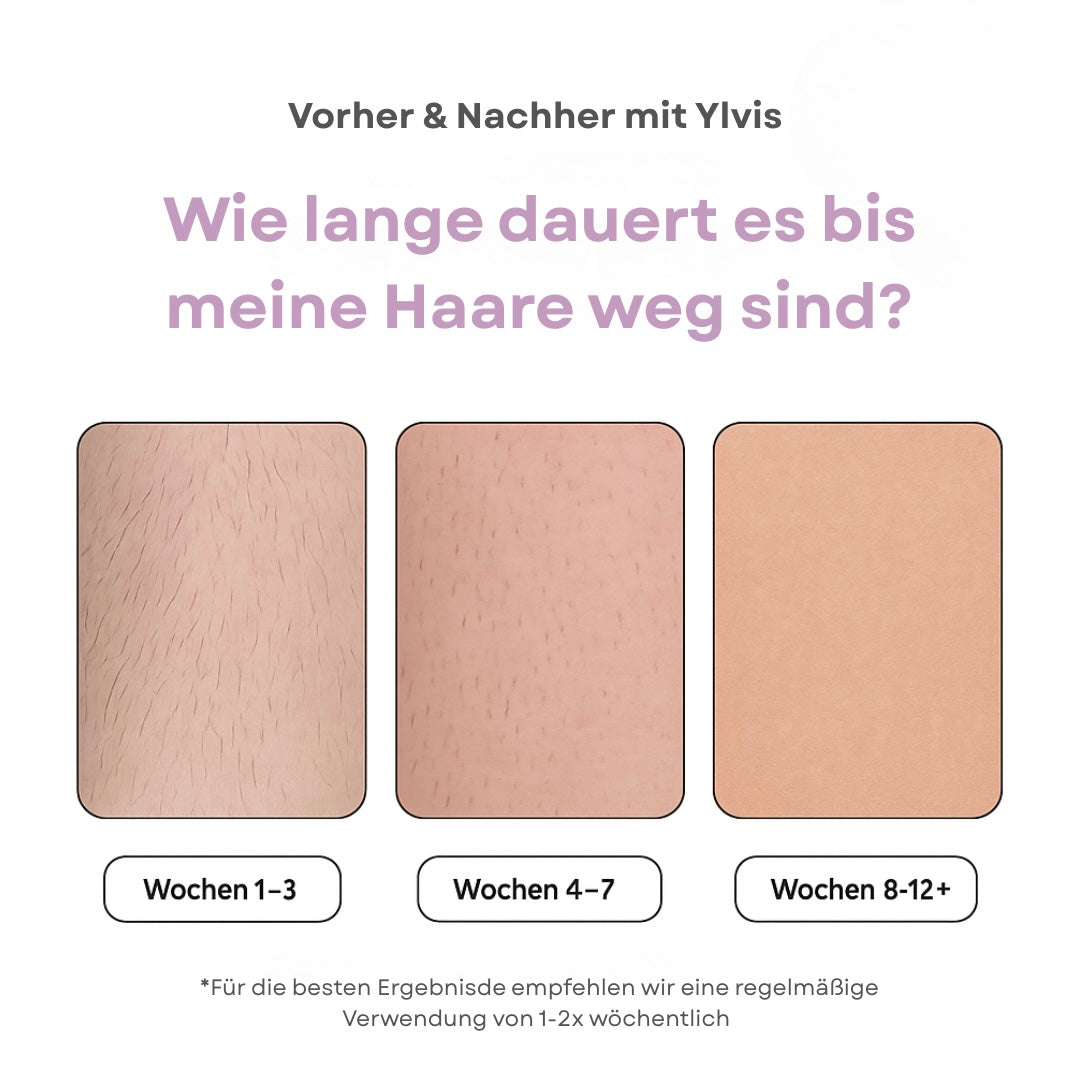 MILONDA Hair Remover - Deine schmerzfreie Revolution für seidig glatte Haut!