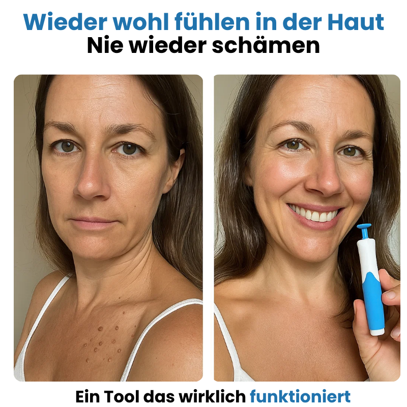 Dermacare – Alcura | Verabschieden Sie sich von Unvollkommenheiten und begrüßen Sie Ihr Selbstvertrauen.