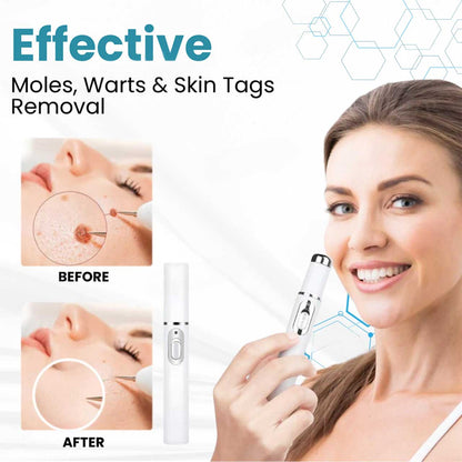 ClearBeam™ Pen - Dein Makelloser Teint Wartet: Erlebe die Haut, von der du immer geträumt hast!