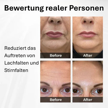 TightShift Serum – Holen Sie sich Ihr jugendliches Aussehen und Ihr Selbstvertrauen zurück.