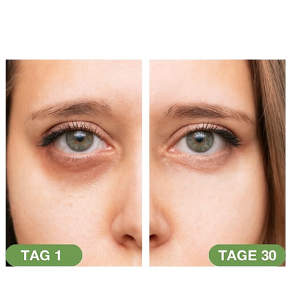 LumiDerm – Holen Sie sich Ihre strahlenden Augen und Ihre jugendliche Ausstrahlung zurück.