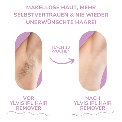 MILONDA Hair Remover - Deine schmerzfreie Revolution für seidig glatte Haut!